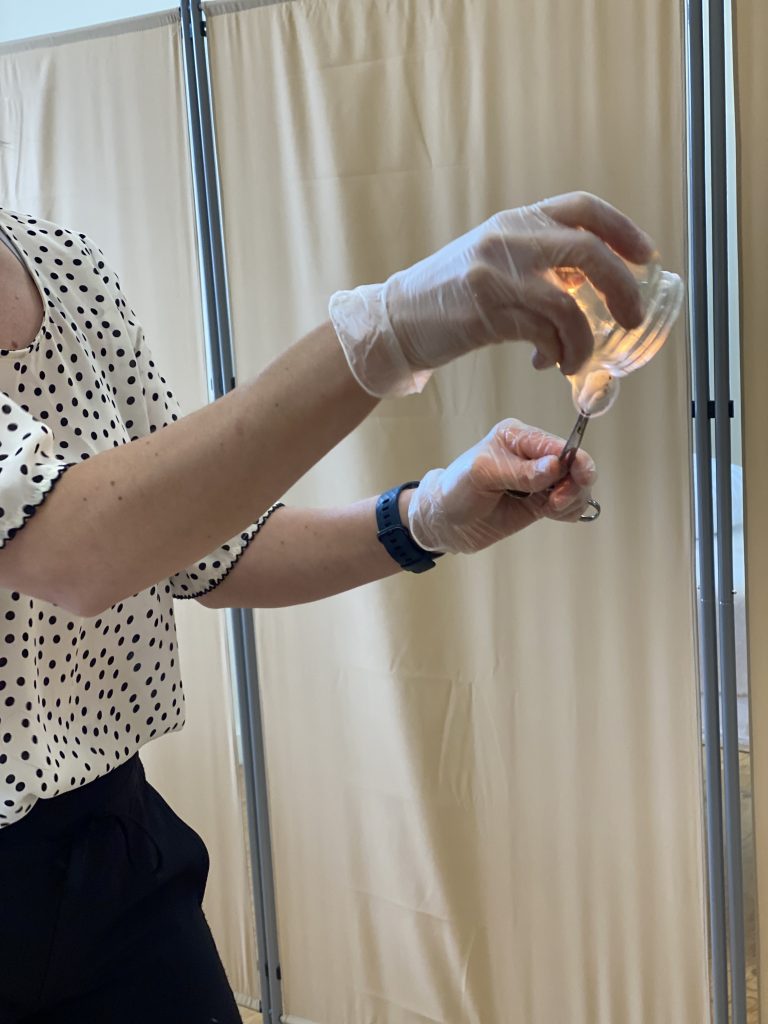 A practitioner preparing a glass cup for fire cupping