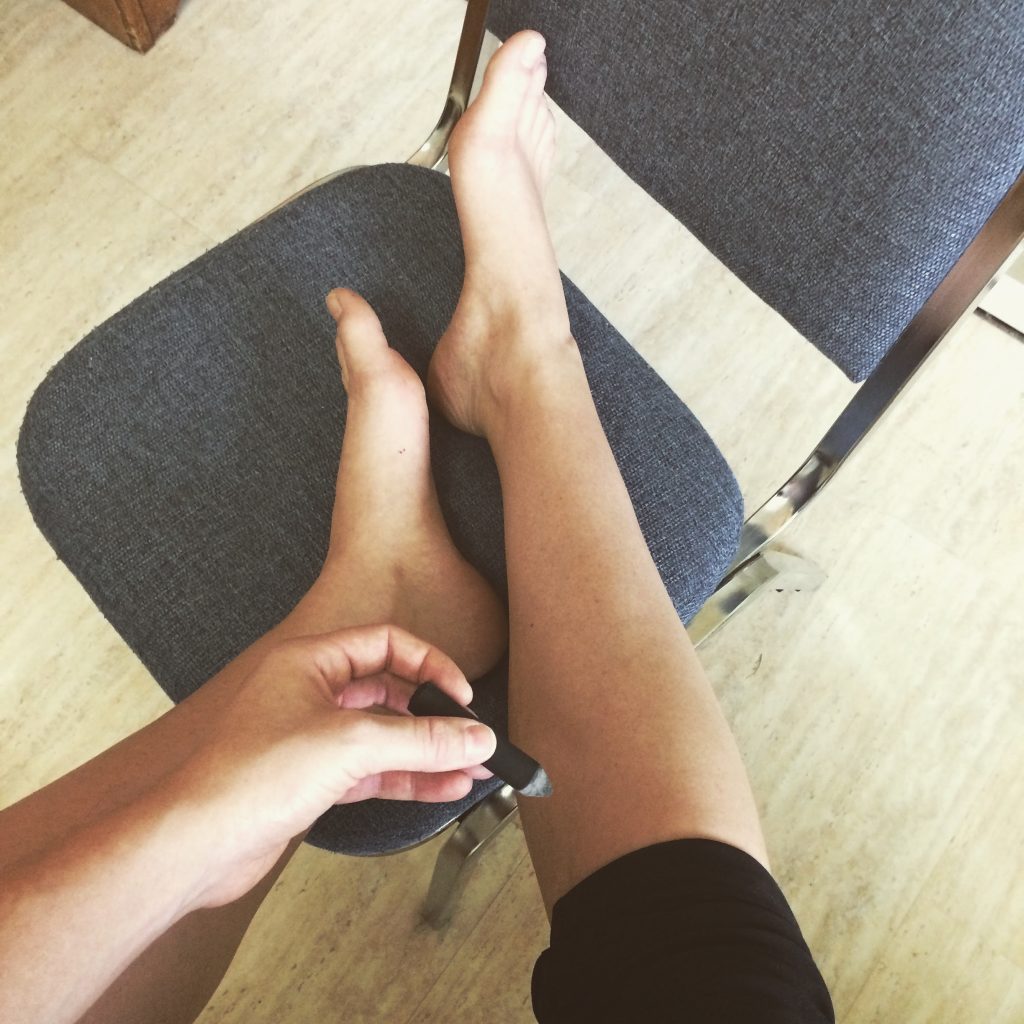 Smokeless moxa being used as a home treatment